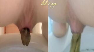 Amazing Distended Assholes ! - video 4, ScatKings.com Scat Porn 6 ScatKings.com Scat Porn