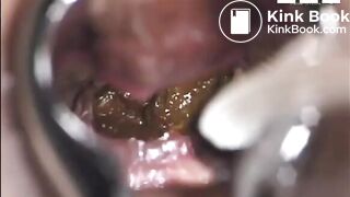Einblick, ScatKings.com Scat Porn 18 ScatKings.com Scat Porn