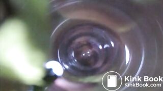 Observation Inside Anus, ScatKings.com Scat Porn 9 ScatKings.com Scat Porn