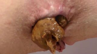 closeup6, ScatKings.com Scat Porn 9 ScatKings.com Scat Porn