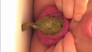 prolapsed japanese open wide, ScatKings.com Scat Porn 4 ScatKings.com Scat Porn