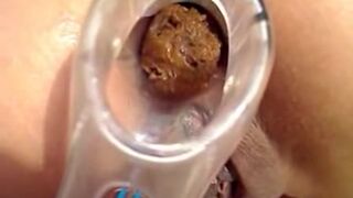 shitting in speculum, ScatKings.com Scat Porn 5 ScatKings.com Scat Porn